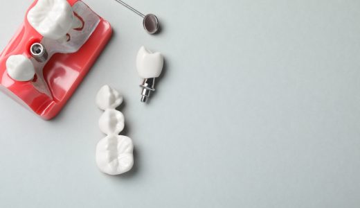 インプラントのメンテナンス方法！歯科医院で受ける場合と自宅で行う方法を紹介