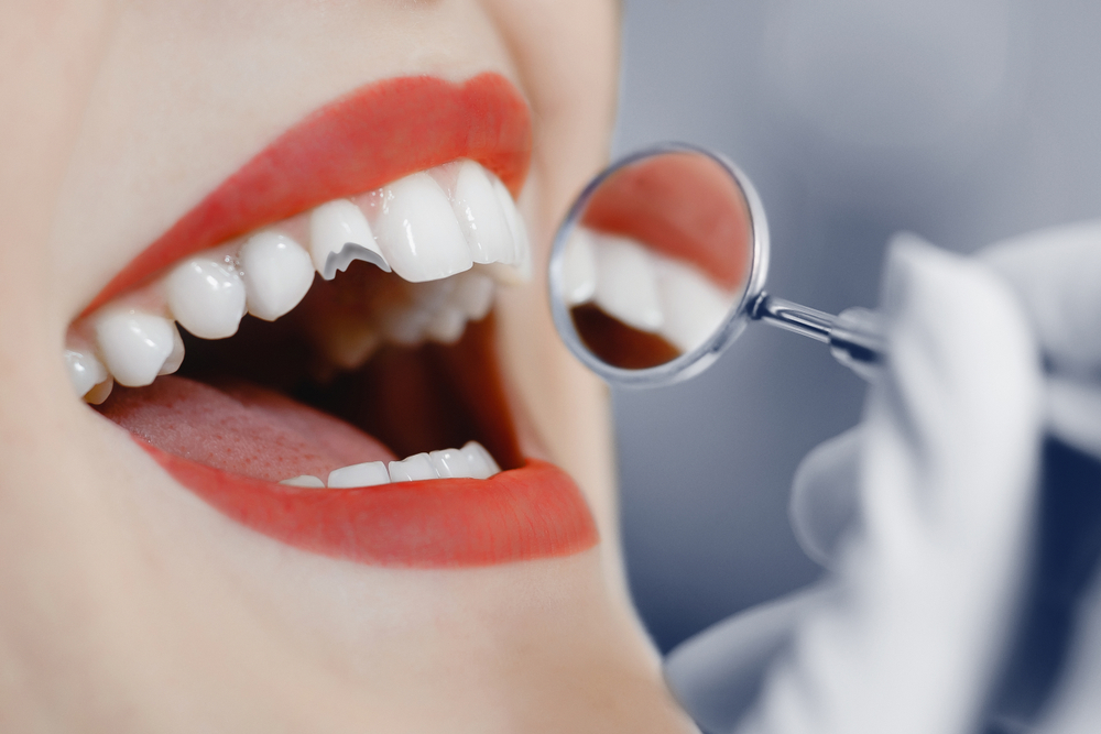 歯科医療において補綴治療が重要な理由