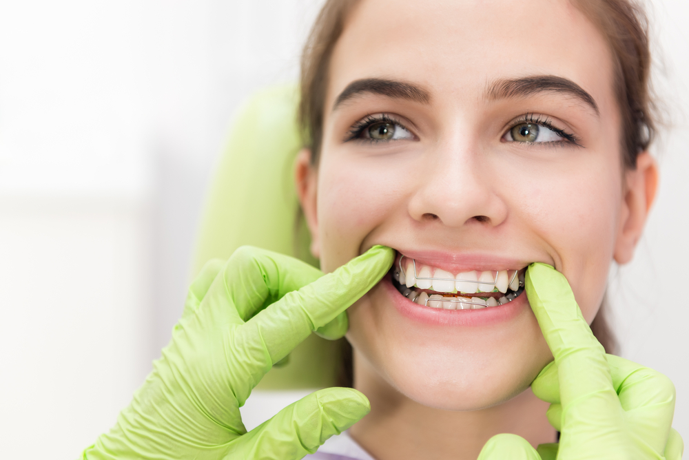 インプラント治療後の歯列矯正の可否を調べる方法