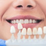 前歯をインプラントにする場合に注意点が多い理由と成功の秘訣を解説