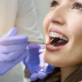 インプラント治療後に歯の矯正は可能！ただし難しいケースもあります