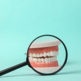 永久歯の本数が足りない先天性欠如歯の治療にインプラントが適する理由
