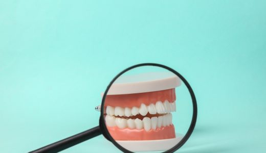 永久歯の本数が足りない先天性欠如歯の治療にインプラントが適する理由