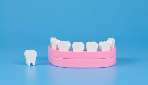 インプラント治療では歯並びを治せない？おすすめの治療法を解説