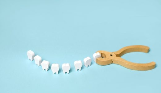 抜歯の最大の原因は歯周病！重度になった場合の選択肢は？