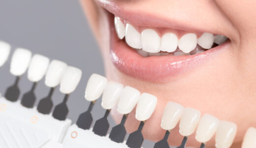 審美歯科治療を受ける歯科医院の選び方を解説